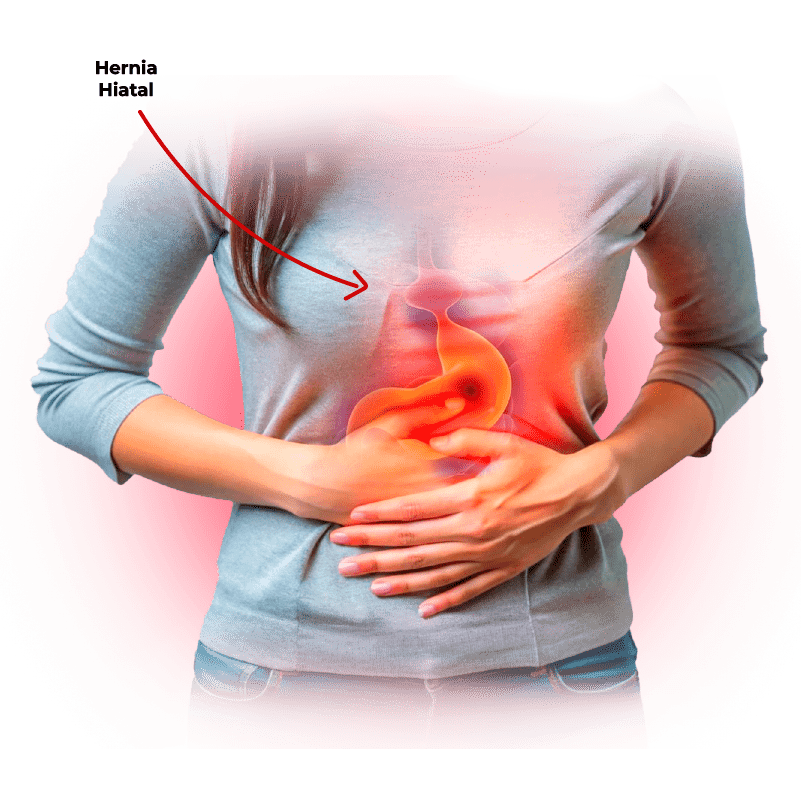 dr-javier-guevara-especialista-hernia-hiatal