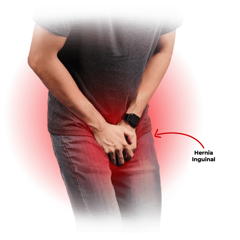 dr-javier-guevara-especialista-hernia-inguinal