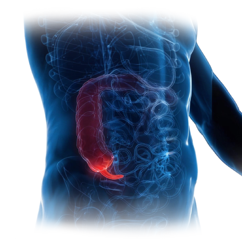 laparoscopia-apendicitis-seguridad-chihuahua